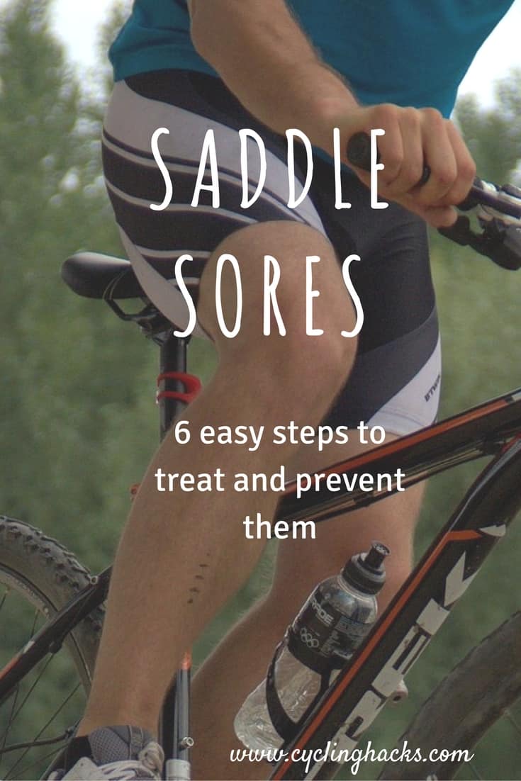 saddle sores 